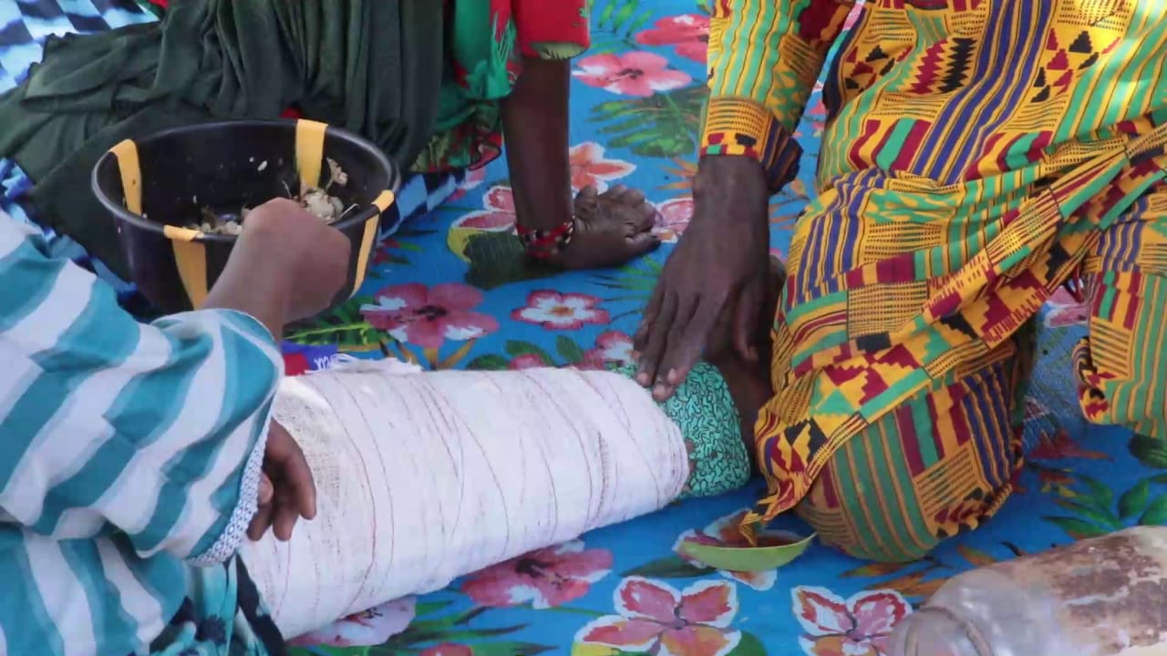 Kankan : &agrave; Banankoni, une famille perp&eacute;tue un savoir-faire traditionnel autour des fractures
